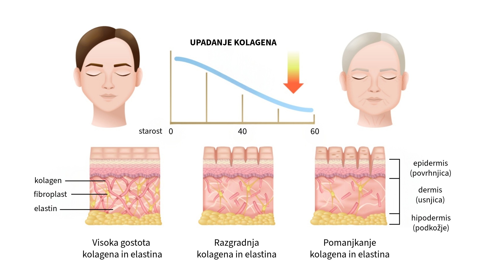 staranje koze se zacne v globini